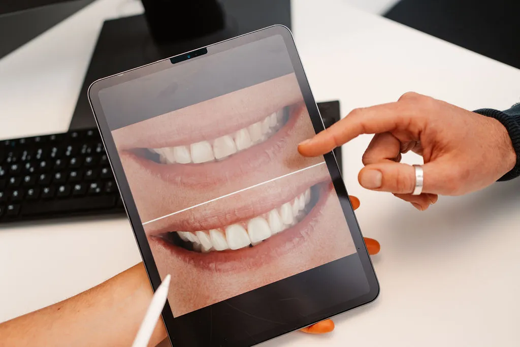 Tablet mit Vorher-Nachher-Vergleich eines Lächelns zur Visualisierung ästhetischer Zahnkorrekturen.