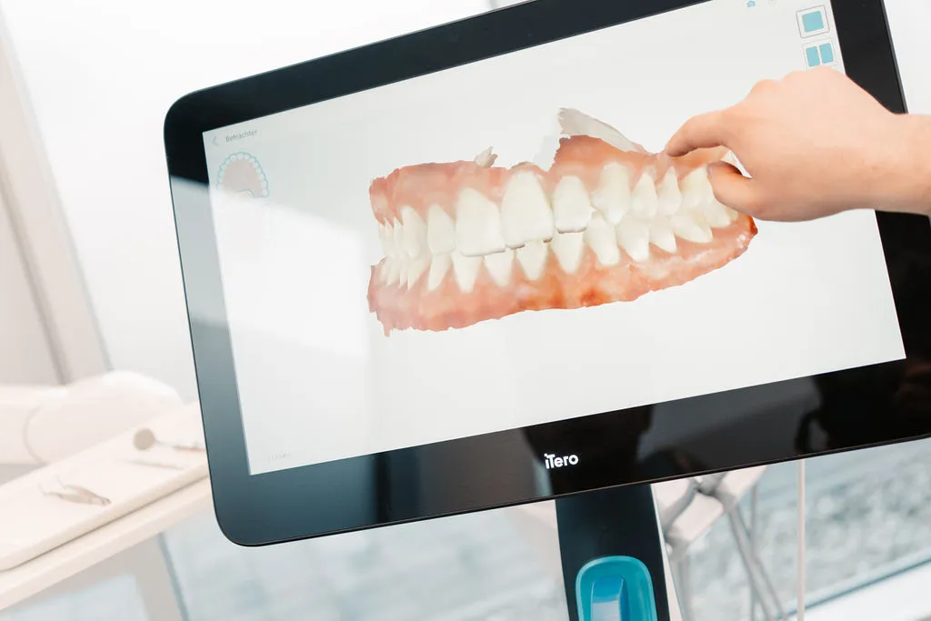 Digitale 3D-Darstellung eines Kiefers auf einem iTero-Scanner, verwendet zur präzisen Planung kieferorthopädischer Behandlungen.