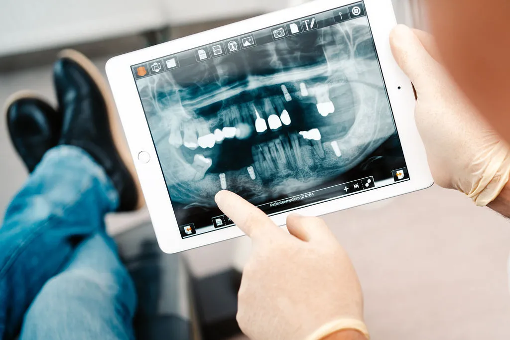 Zahnarzt zeigt auf einem Tablet ein digitales Röntgenbild mit mehreren Zahnimplantaten, im Hintergrund liegt ein Patient auf dem Behandlungsstuhl.
