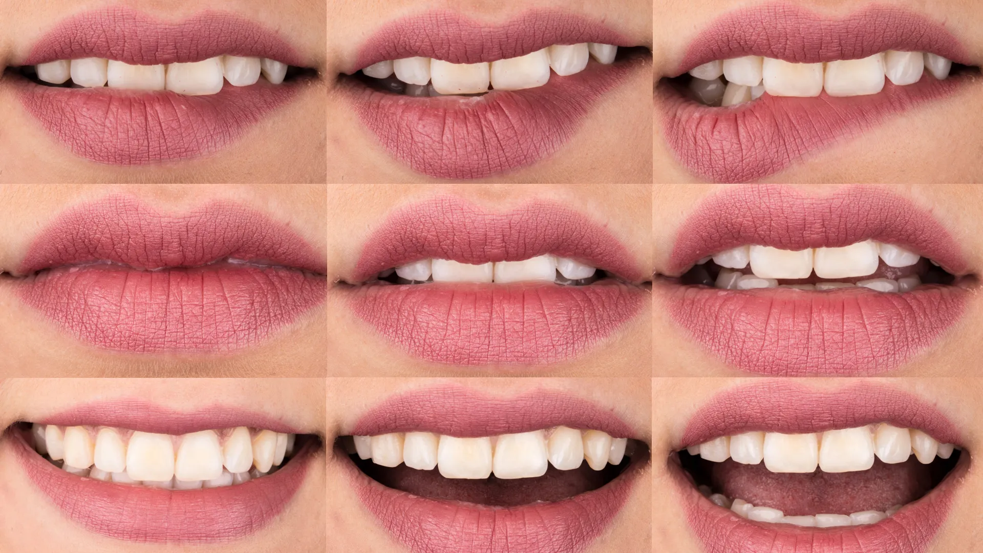 Dental Photography von 9 Münder.